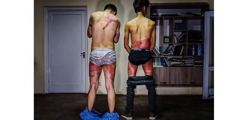 Afghan Journalists Tortured With Whips, Cables And Batons For Covering Women's Protest