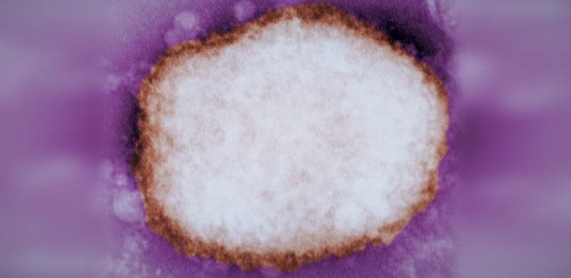 Pakistan Issues Monkeypox Alert: All You Need To Know About The Virus