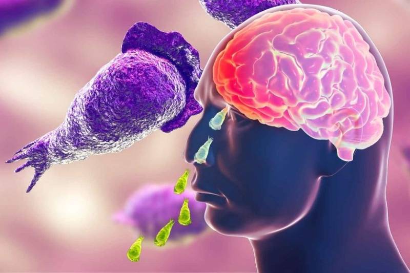 Naegleria Fowleri Threat Looms Large In Karachi: Urgent Steps Needed To Stem The Tide